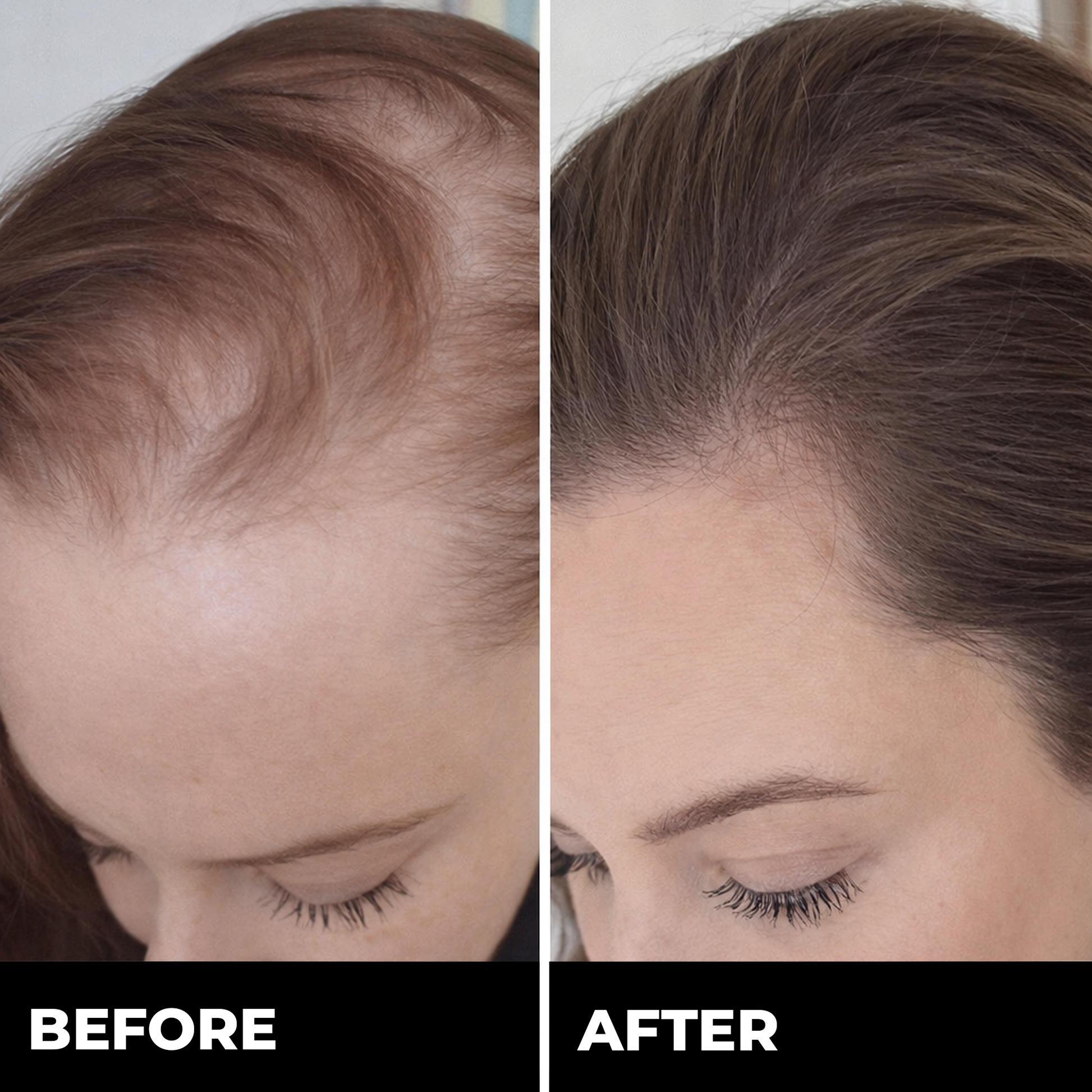 Zylo HAIRREGROW+