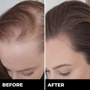 Zylo HAIRREGROW+