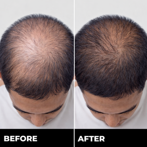 Zylo HAIRREGROW+