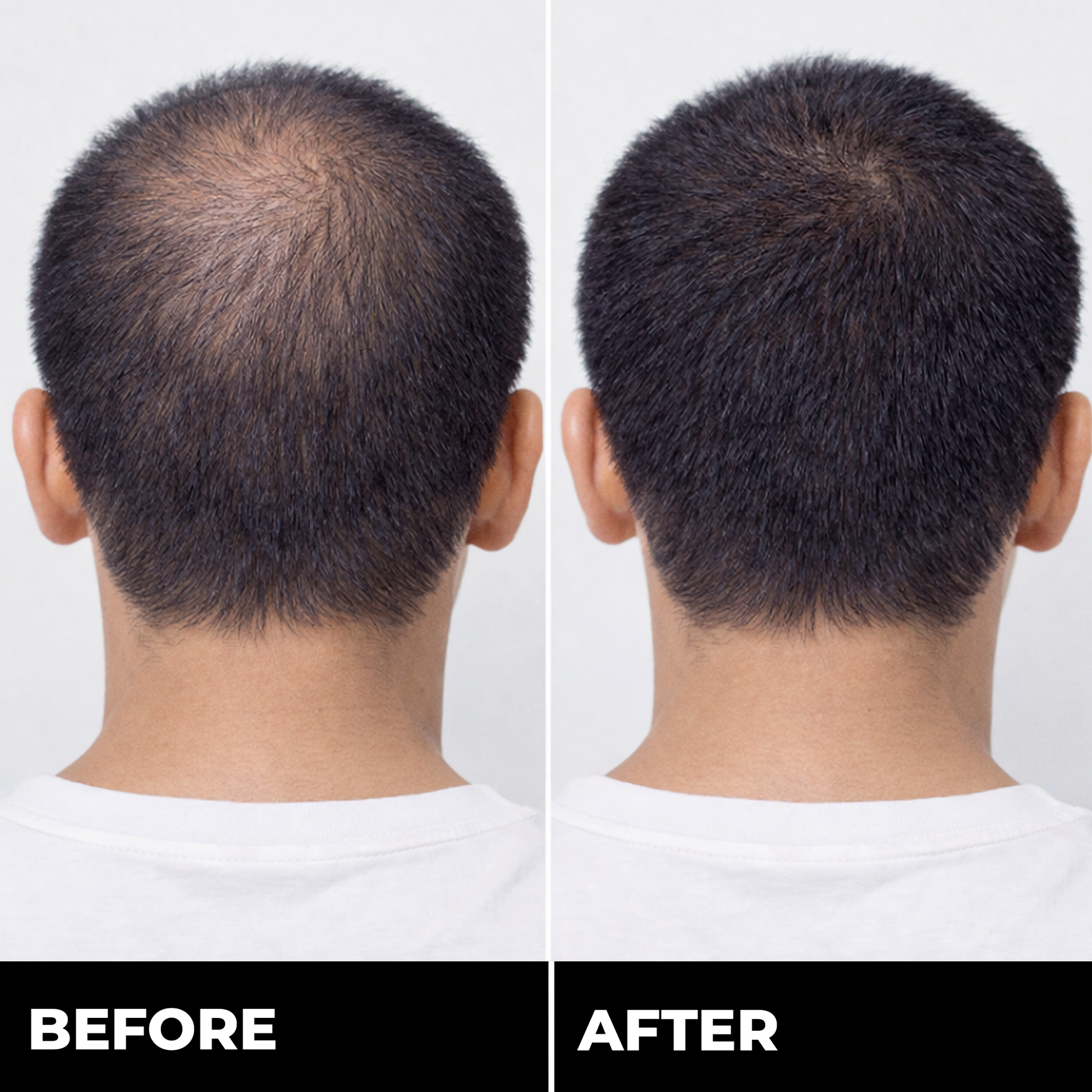 Zylo HAIRREGROW+