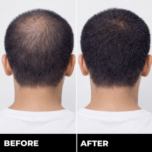 Zylo HAIRREGROW+
