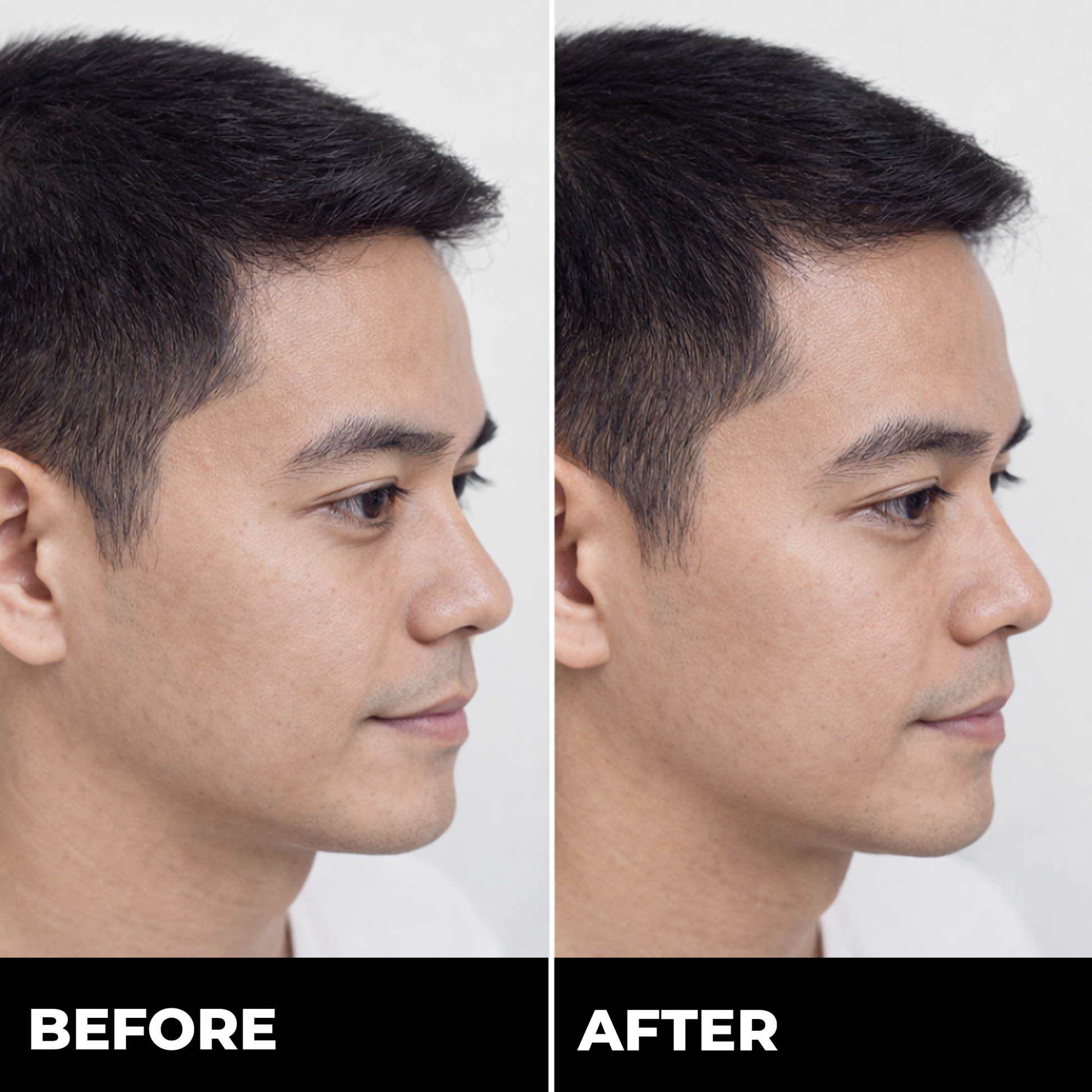 Zylo HAIRREGROW+