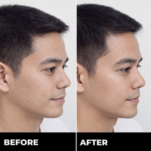Zylo HAIRREGROW+
